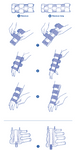 MANULOC LONG® - Orthèse de stabilisation du poignet avec levier plus long 🪪