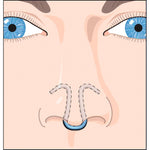 CLIP AIR - Dilateur nasal pour respiration optimale